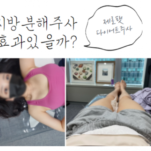 #잠실점#제로팻#지방분해