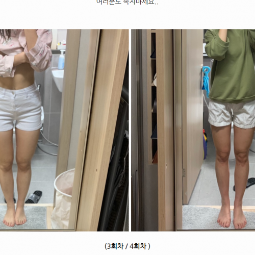#제로팻#허벅지#인천점
